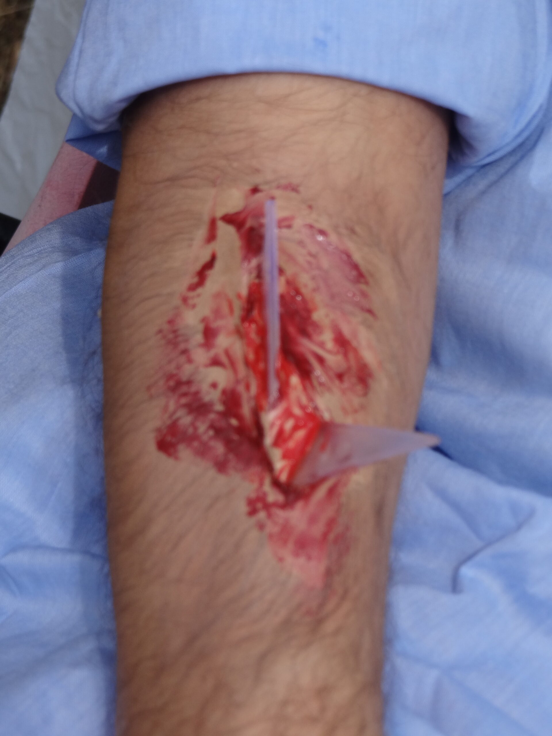 Croce Rossa Italiana - Comitato di Arenzano