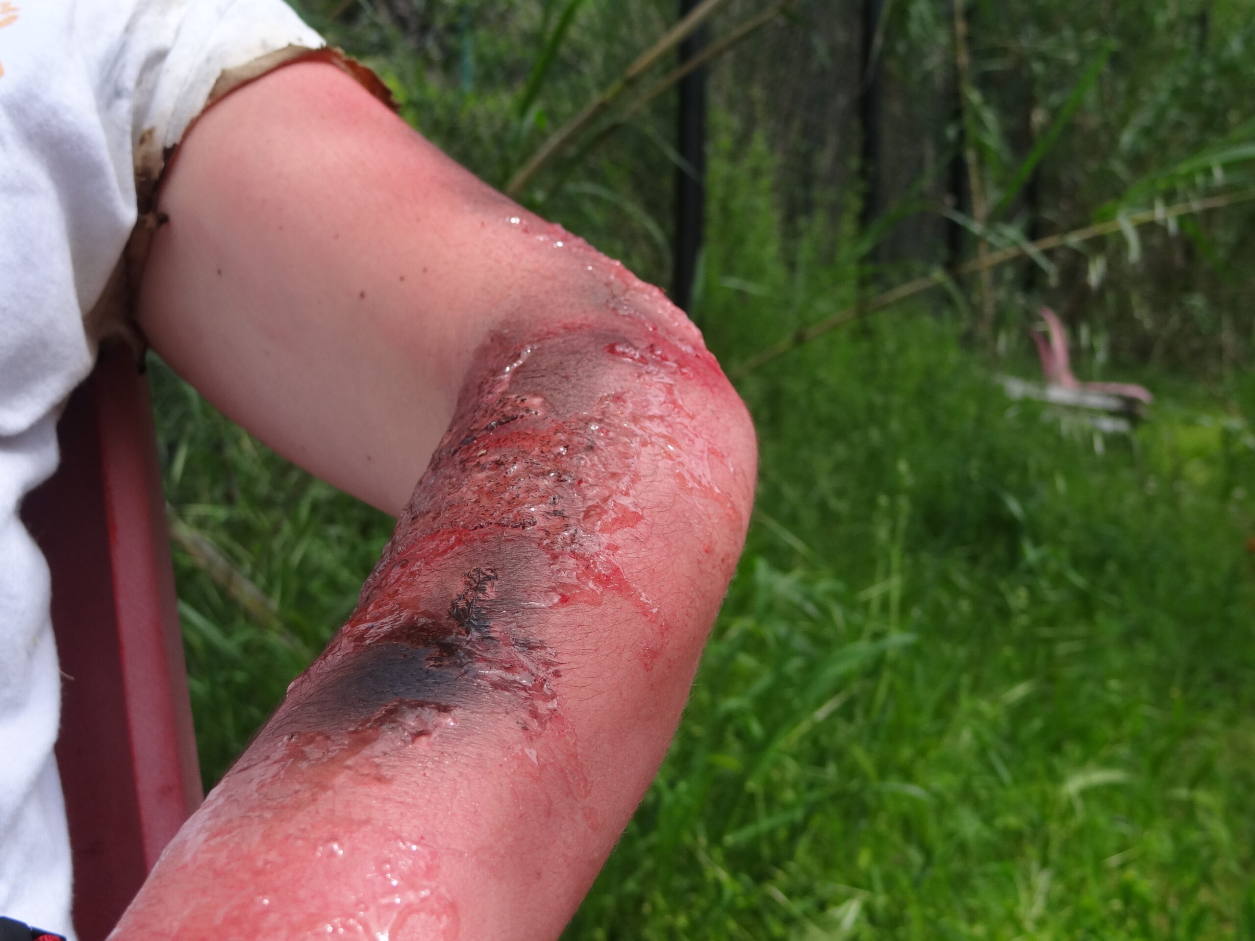 Croce Rossa Italiana - Comitato di Arenzano