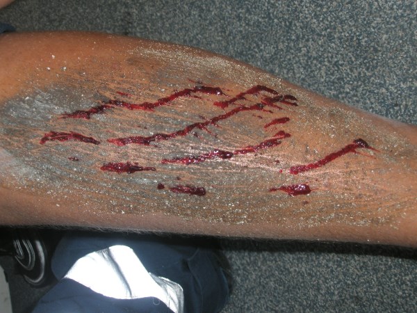 Croce Rossa Italiana - Comitato di Arenzano