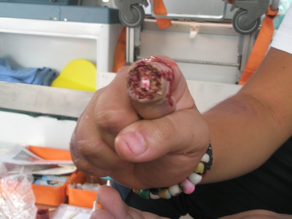 Croce Rossa Italiana - Comitato di Arenzano