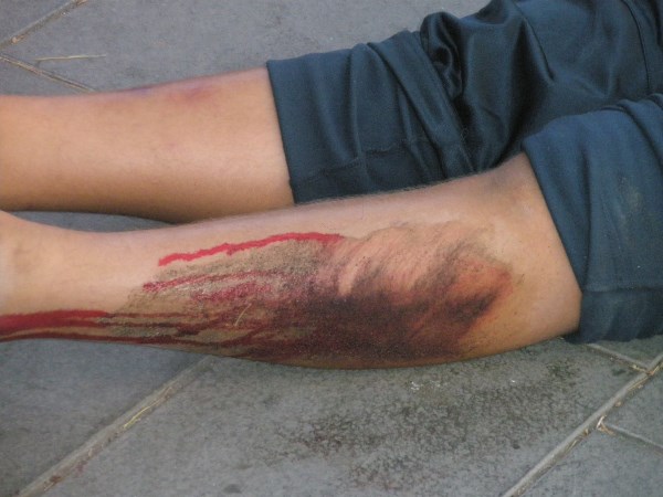 Croce Rossa Italiana - Comitato di Arenzano