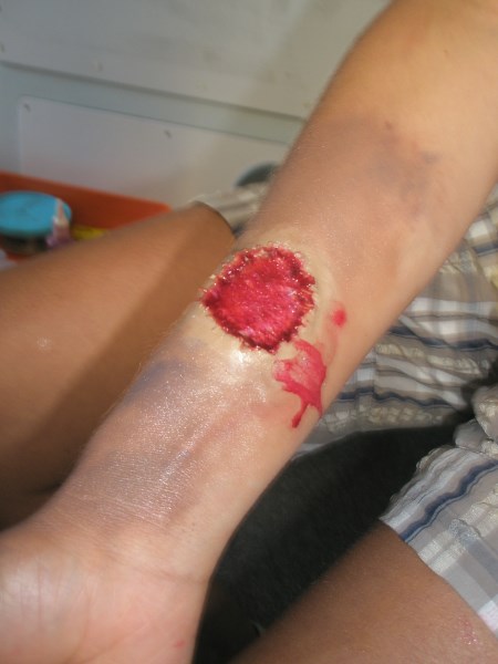 Croce Rossa Italiana - Comitato di Arenzano