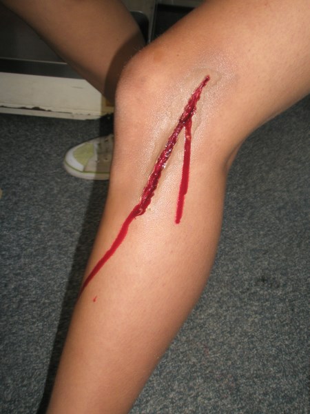 Croce Rossa Italiana - Comitato di Arenzano