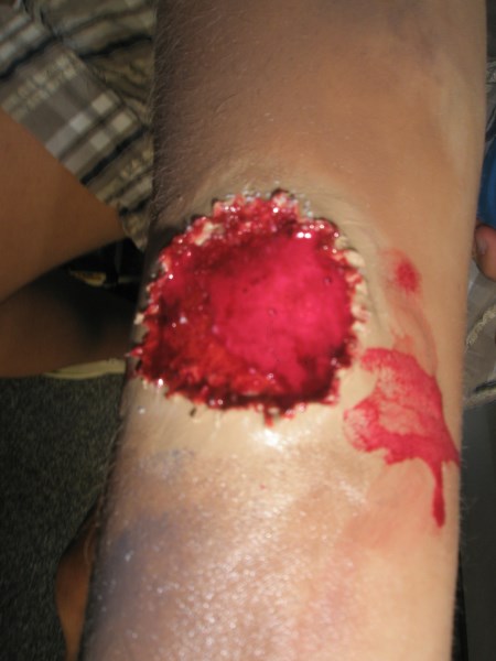 Croce Rossa Italiana - Comitato di Arenzano