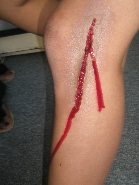 Croce Rossa Italiana - Comitato di Arenzano